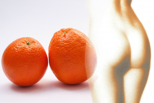 Cellulite: causes et conseils pour l'éliminer lifestyle Non classé cellulite conseil pour l'eviter cellulite beauté xekios Cellulite: causes et conseils pour l'éliminer lifestyle Non classé cellulite conseil pour l'eviter cellulite beauté